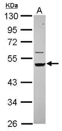 Anti-Cytokeratin 14 antibody [N3C3] used in Western Blot (WB). GTX112976