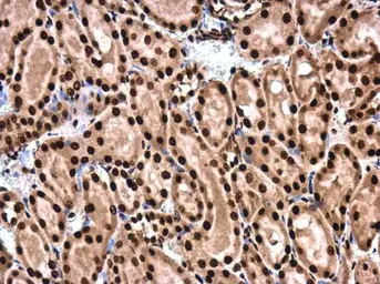Anti-SMAD4 antibody used in IHC (Paraffin sections) (IHC-P). GTX112980