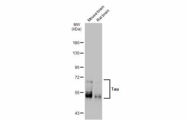 Anti-Tau antibody used in Western Blot (WB). GTX112981