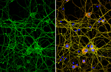 Anti-Tau antibody used in Immunocytochemistry/ Immunofluorescence (ICC/IF). GTX112981