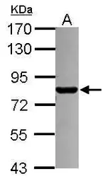 Anti-PML antibody [N1N2], N-term used in Western Blot (WB). GTX112996