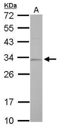 Anti-RPA32 antibody used in Western Blot (WB). GTX113004