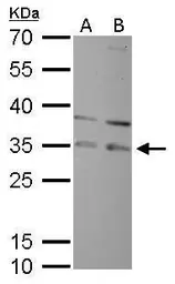 Anti-RPA32 antibody used in Western Blot (WB). GTX113004