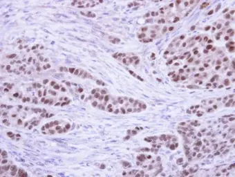 Anti-RPA32 antibody used in IHC (Paraffin sections) (IHC-P). GTX113004