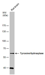 Anti-Tyrosine Hydroxylase antibody used in Western Blot (WB). GTX113016