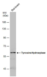 Anti-Tyrosine Hydroxylase antibody used in Western Blot (WB). GTX113016
