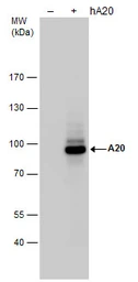 Anti-TNFAIP3 antibody used in Western Blot (WB). GTX113027
