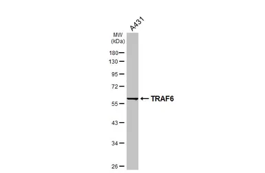 Anti-TRAF6 antibody [N2C2], Internal used in Western Blot (WB). GTX113029