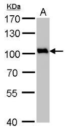 Anti-VCP antibody [N1N2], N-term used in Western Blot (WB). GTX113030