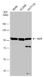 Anti-VCP antibody [N1N2], N-term used in Western Blot (WB). GTX113030