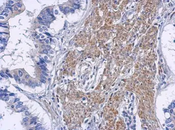 Anti-RIP2 antibody used in IHC (Paraffin sections) (IHC-P). GTX113044