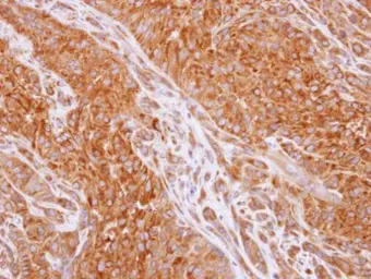 Anti-RIP2 antibody [C1C3] used in IHC (Paraffin sections) (IHC-P). GTX113045