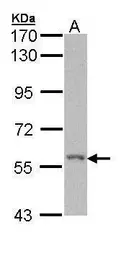 Anti-RIP2 antibody [C1C3] used in Western Blot (WB). GTX113045