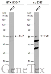 Anti-FLIP antibody [N1C1] used in Western Blot (WB). GTX113047
