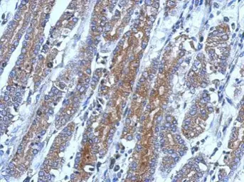 Anti-FLIP antibody [N1C1] used in IHC (Paraffin sections) (IHC-P). GTX113047