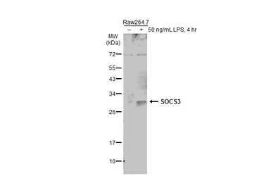 Anti-SOCS3 antibody [N1C3] used in Western Blot (WB). GTX113049