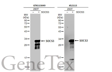 Anti-SOCS3 antibody [N1C3] used in Western Blot (WB). GTX113049