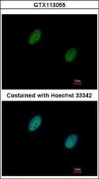 Anti-Chk2 antibody used in Immunocytochemistry/ Immunofluorescence (ICC/IF). GTX113055