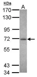 Anti-Chk2 antibody used in Western Blot (WB). GTX113055