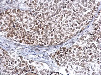 Anti-HDAC2 antibody used in IHC (Paraffin sections) (IHC-P). GTX113086