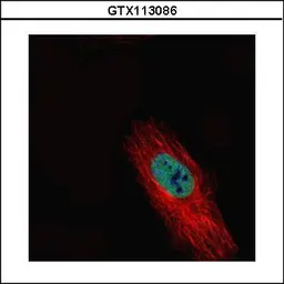 Anti-HDAC2 antibody used in Immunocytochemistry/ Immunofluorescence (ICC/IF). GTX113086
