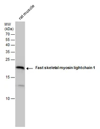 Anti-Fast skeletal myosin light chain 1 antibody used in Western Blot (WB). GTX113092