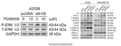 Anti-ERK2 antibody [N2C3] used in Western Blot (WB). GTX113094