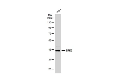 Anti-ERK2 antibody [N2C3] used in Western Blot (WB). GTX113094