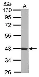 Anti-ERK2 antibody [N2C3] used in Western Blot (WB). GTX113094