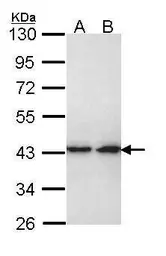 Anti-ERK2 antibody [N2C3] used in Western Blot (WB). GTX113094