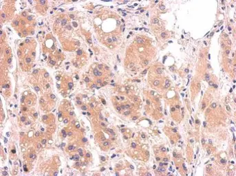 Anti-Diablo antibody [N1C3-3] used in IHC (Paraffin sections) (IHC-P). GTX113108