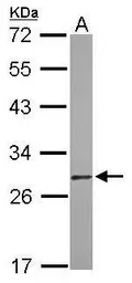 Anti-Diablo antibody [N1C3-3] used in Western Blot (WB). GTX113108