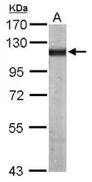 Anti-alpha Actinin 4 antibody [N2C1], Internal used in Western Blot (WB). GTX113115