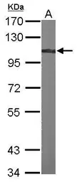 Anti-alpha Actinin 4 antibody [N2C1], Internal used in Western Blot (WB). GTX113115