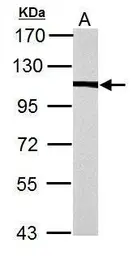 Anti-alpha Actinin 4 antibody [N2C1], Internal used in Western Blot (WB). GTX113115