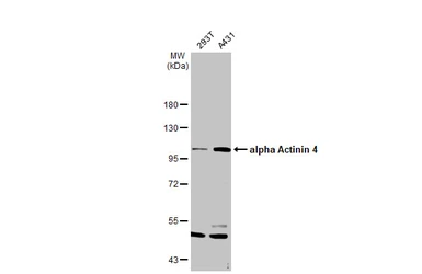 Anti-alpha Actinin 4 antibody [N2C1], Internal used in Western Blot (WB). GTX113115