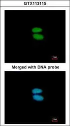 Anti-alpha Actinin 4 antibody [N2C1], Internal used in Immunocytochemistry/ Immunofluorescence (ICC/IF). GTX113115