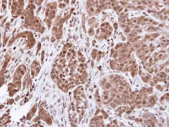 Anti-alpha Actinin 4 antibody [N2C1], Internal used in IHC (Paraffin sections) (IHC-P). GTX113115