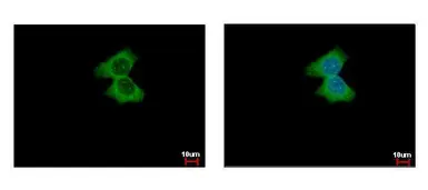 Anti-alpha Actinin 4 antibody [N1N2], N-term used in Immunocytochemistry/ Immunofluorescence (ICC/IF). GTX113116