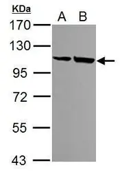 Anti-alpha Actinin 4 antibody [N1N2], N-term used in Western Blot (WB). GTX113116