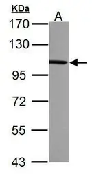 Anti-alpha Actinin 4 antibody [N1N2], N-term used in Western Blot (WB). GTX113116