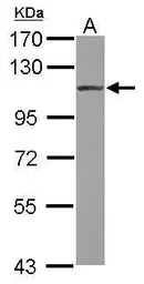 Anti-alpha Actinin 4 antibody [N1N2], N-term used in Western Blot (WB). GTX113116
