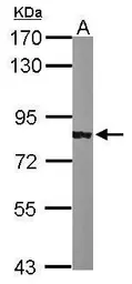 Anti-alpha Adducin antibody [N1N2], N-term used in Western Blot (WB). GTX113118