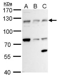 Anti-alpha Adducin antibody [N1N2], N-term used in Western Blot (WB). GTX113118
