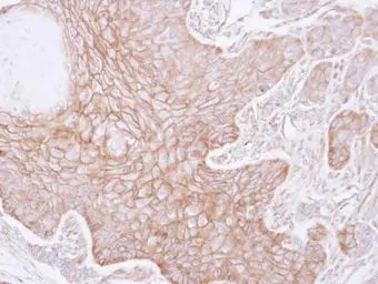 Anti-alpha Adducin antibody [N1N2], N-term used in IHC (Paraffin sections) (IHC-P). GTX113118