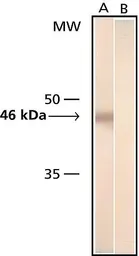 Anti-beta Tubulin 3/ Tuj1 antibody [SDL.3D10] used in Western Blot (WB). GTX11314