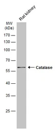 Anti-Catalase antibody [N2C1], Internal used in Western Blot (WB). GTX113149