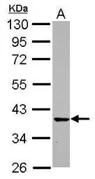 Anti-CDK6 antibody [N3C3] used in Western Blot (WB). GTX113159