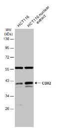 Anti-CDX2 antibody used in Western Blot (WB). GTX113160