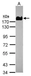 Anti-CD66e antibody [N1N3] used in Western Blot (WB). GTX113161